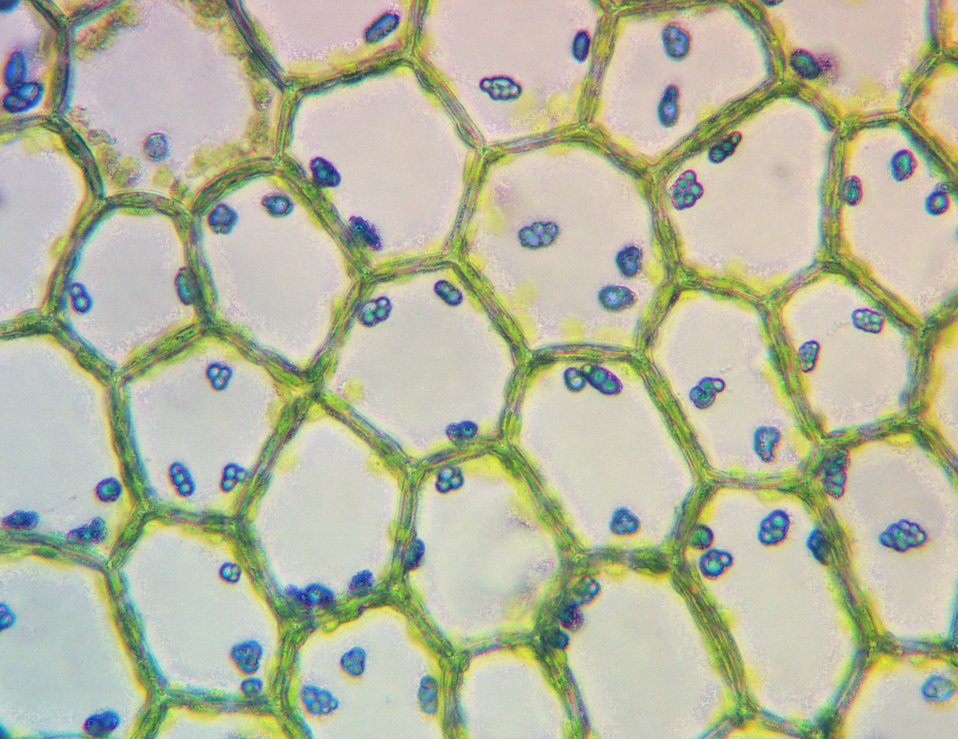 calypogeia orientalis k-99-24-21_1_ Масляные тела внутри клеток Calypogeia orientalis Buczk. & Bakalin. Фото В.А. Бакалина.